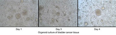 Organoids
